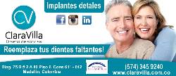 Implantes dentales - Implantologa - consultorio Medellin, Colombia