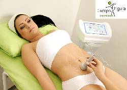 ULTRACAVITACIN EN MEDELLIN CUERPO Y FIGURA EC Medellin, colombia