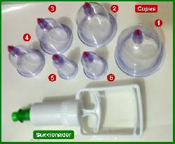 Vacumterapia de Alta Succi�n con set de 6 copas.  Bogota, Colombia